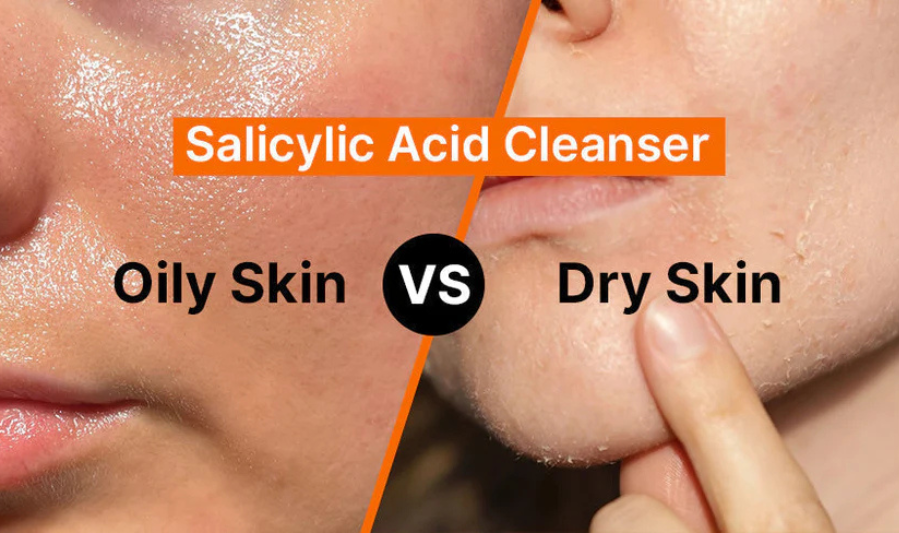 Cleansing for Dry Skin