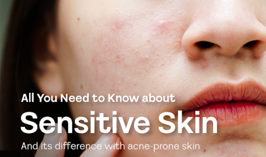What Causes Sensitive Skin