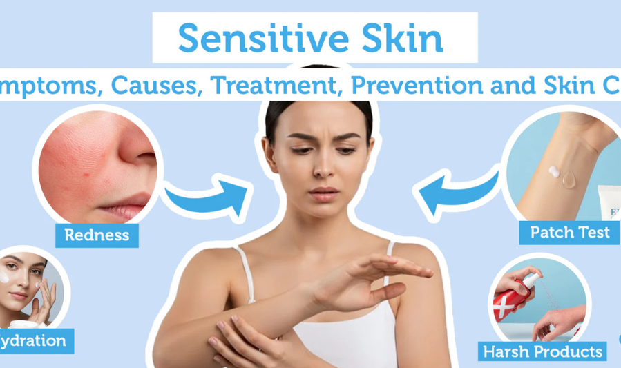 What Is Sensitive Skin